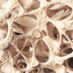 ostéoporose Cheef conseils experts minceur
