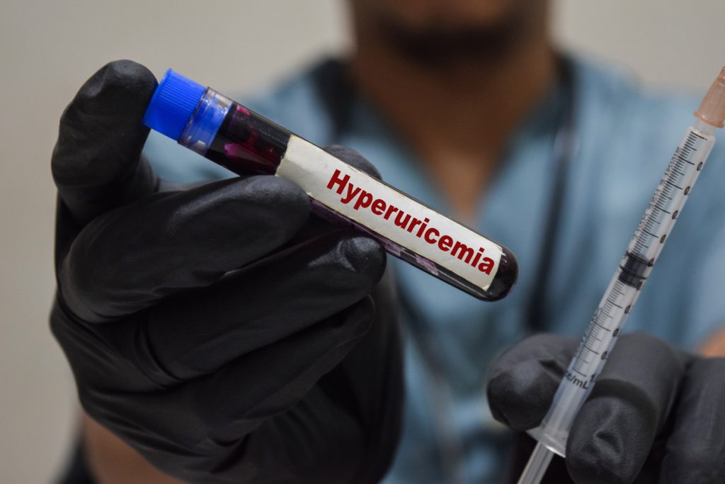 Hyperuricémie