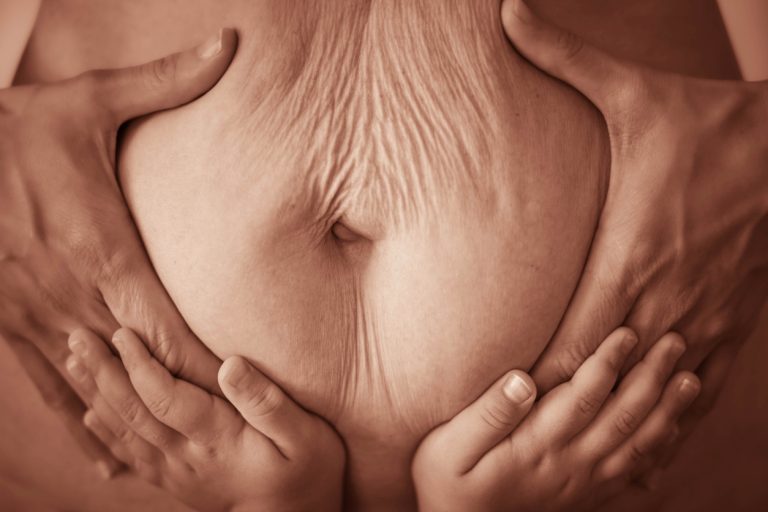 Perte de poids post partum